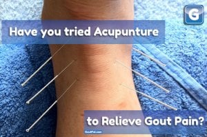 Does Gout Pain and Acupuncture work for you?